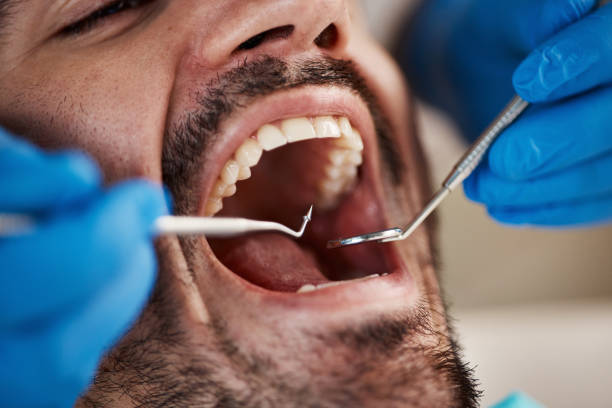 Best Emergency Dental Surgery in Shafer, MN